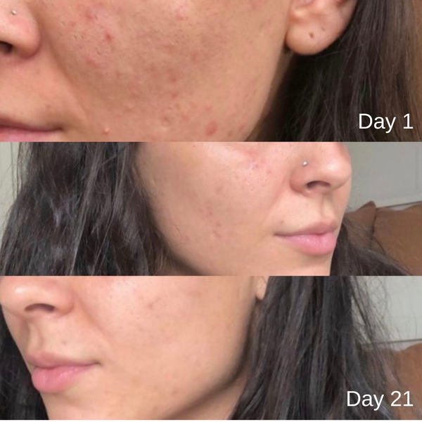 Expose Balancing Serum